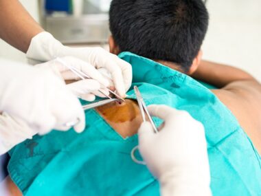 skin samples for analysis