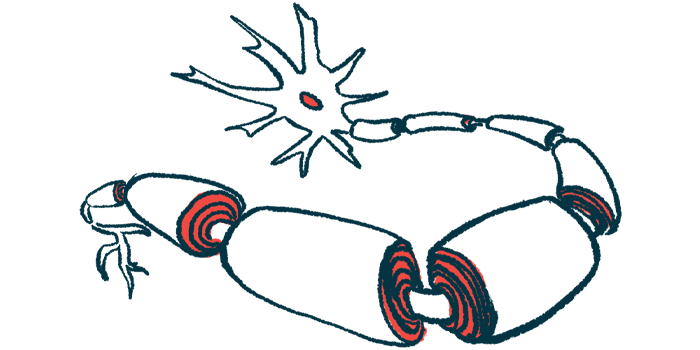 An illustration shows neurons with damaged myelin.