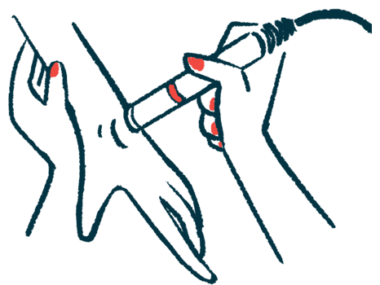 Stimulation is being given to a person's hand.