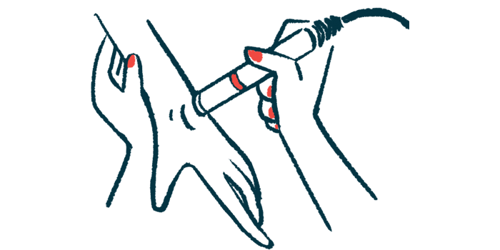 Stimulation is being given to a person's hand.