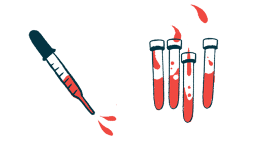 A dropper squirting blood is seen alongside four half-filled vials.