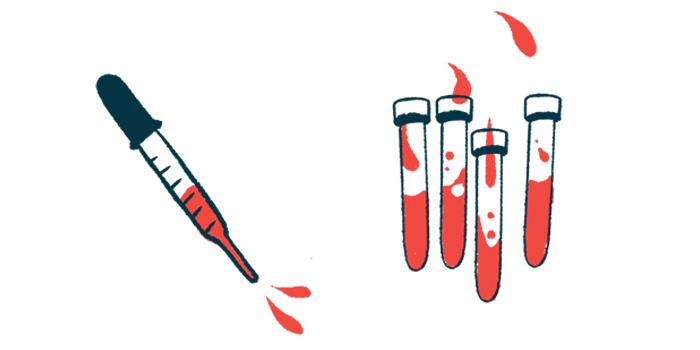 A dropper squirting blood is seen alongside four half-filled vials.