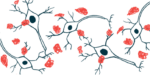 An illustration shows a close-up view of amyloid plaques, or protein clumps.