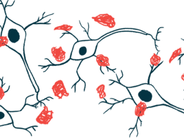 An illustration shows a close-up view of amyloid plaques, or protein clumps.
