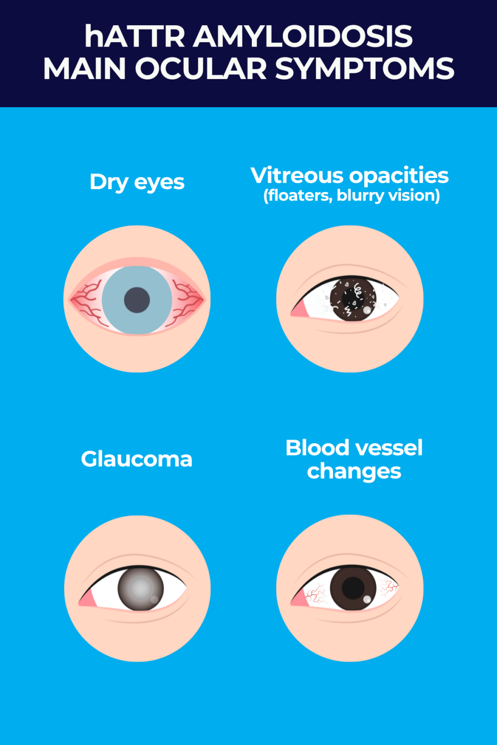 Hattr hATTR amyloidosis: Eye symptoms and solutions | Amyloidosis News Today