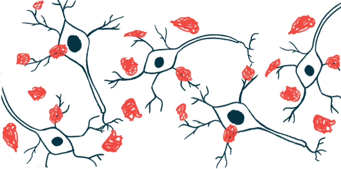 An illustration shows a close-up view of widespread damage in nerve cells.